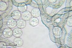 01_m_Arcyria_cinerea_20090702S06_4039_OBR