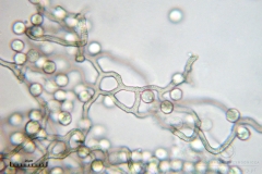 02_m_Arcyria_cinerea_20090702S06_4036_OBR