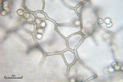 03_m_Arcyria_cinerea_20090702S06_4035_OBR