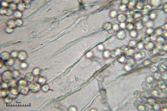 04_m_Arcyria_cinerea_20090702S06_4031_OBR