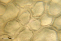 06_m_Arcyria_cinerea_20090702S06_4046_OBR