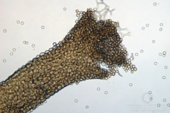 07_m_Arcyria_cinerea_20090702S06_4028_OBR