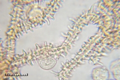02_m_Arcyria_denudata_20090809S01_4068_OBR