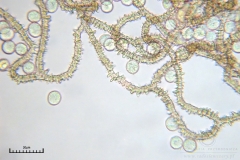 04_m_Arcyria_denudata_20090809S01_4078_OBR