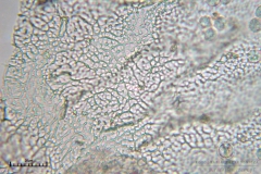 06_m_Arcyria_denudata_20090809S01_4061_OBR