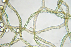 04_m_Arcyria-_obvelata_20090623S01_3970_OBR