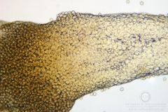 05_m_Arcyria-_obvelata_20090623S01_3968_OBR