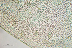 07_m_Arcyria-_obvelata_20090623S01_3966_OBR