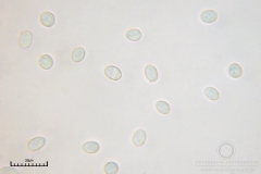 01_Ceratomyxa_fruticulosa_20100607S01_S6307171_obr