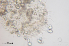 02_Ceratomyxa_fruticulosa_20100607S01_S6307161_obr
