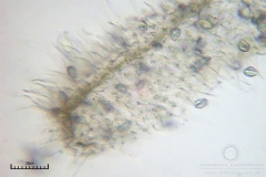 03_Ceratomyxa_fruticulosa_20100607S01_S6307170_obr