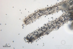 04_Ceratomyxa_fruticulosa_20100607S01_S6307167_obr