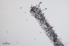 05_Ceratomyxa_fruticulosa_20100607S01_S6307164_obr