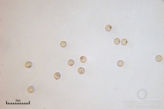 01_Cribraria_cancellata_20100605S01_S6307131_obr
