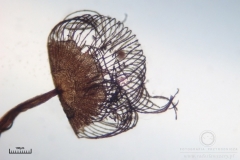 05_Cribraria_cancellata_20100605S01_S6307126_obr