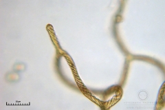 04_m_Hemitrichia_clavata_20090927S02_4235_OBR