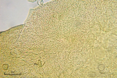 06_m_Hemitrichia_clavata_20090927S02_4220_OBR
