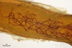 08_m_Hemitrichia_clavata_20090927S02_4229_OBR