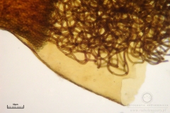 09_m_Hemitrichia_clavata_20090927S02_4228)OBR