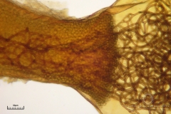 10_m_Hemitrichia_clavata_20090927S02_4227_OBR
