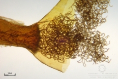 11_m_Hemitrichia_clavata_20090927S02_4226_OBR