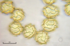 01_m_Hemitrichia_serpula_20090927S03_4261_OBR