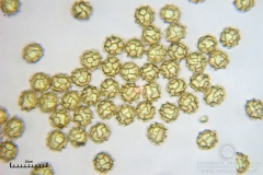 02_m_Hemitrichia_serpula_20090927S03_4244_OBR