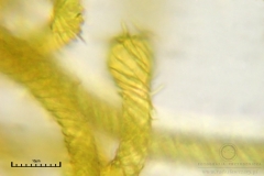 03_m_Hemitrichia_serpula_20090927S03_4256_OBR