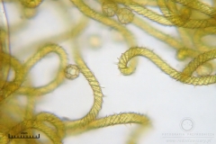 06_m_Hemitrichia_serpula_20090927S03_4250_OBR