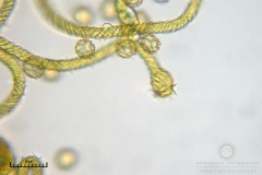 07_m_Hemitrichia_serpula_20090927S03_4248_OBR