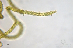 08_m_Hemitrichia_serpula_20090927S03_4246_OBR