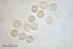01_Lycogala_conicum_20100606S02_S6307148_obr