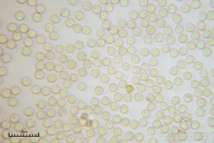 02_Lycogala_conicum_20100606S02_S6307136_obr
