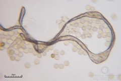 03_Lycogala_conicum_20100620S03_S6307156_obr