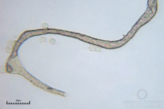 04_Lycogala_conicum_20100606S02_S6307141_obr