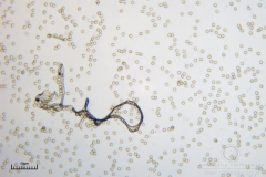 05_Lycogala_conicum_20100620S03_S6307155_obr