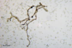 06_Lycogala_conicum_20100606S02_S6307144_obr