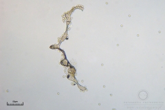 07_Lycogala_conicum_20100606S02_S6307138_obr