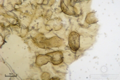 08_Lycogala_conicum_20100606S02_S6307134_obr