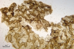 09_Lycogala_conicum_20100620S03_S6307158_obr