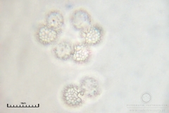 01_m_Lycogala-_epidendrum_20090521S01_3934_OBR