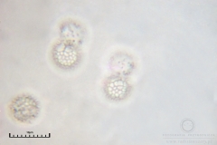 02_m_Lycogala-_epidendrum_20090521S01_3930_OBR