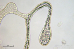 03_m_Lycogala-_epidendrum_20090521S01_3925_OBR