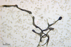 05_m_Lycogala-_epidendrum_20090521S01_3922_OBR