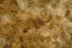 06_m_Lycogala-_epidendrum_20090521S01_3920