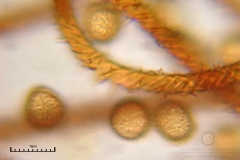 01_m_Metatrichia_vesparia_20090912S01_4193_OBR