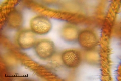 02_m_Metatrichia_vesparia_20090912S01_4189_OBR