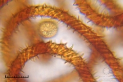 03_m_Metatrichia_vesparia_20090912S01_4188_OBR