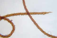 04_m_Metatrichia_vesparia_20090912S01_4179_OBR
