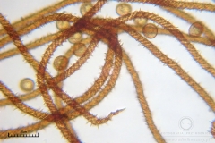 05_m_Metatrichia_vesparia_20090912S01_4181_OBR